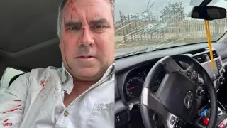 The Peruvian presidential candidate, Rafael Belaunde, after the shooting.